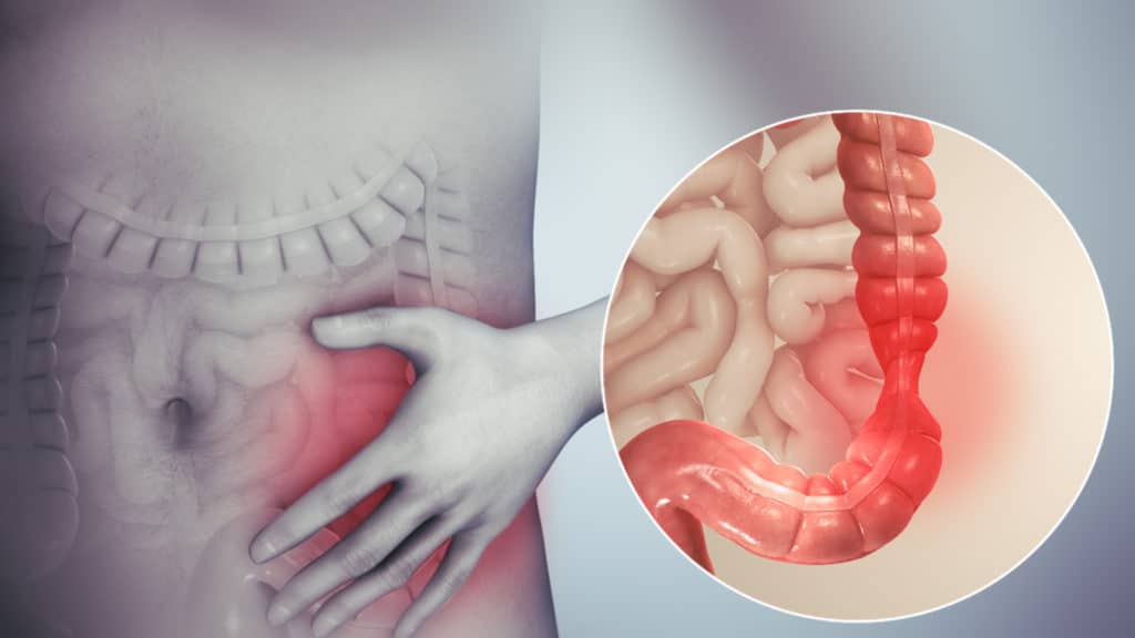 Cibi lassativi,alimenti lassativi,enterogermina intestino pigro,Stitichezza sintomi,Intestino pigro